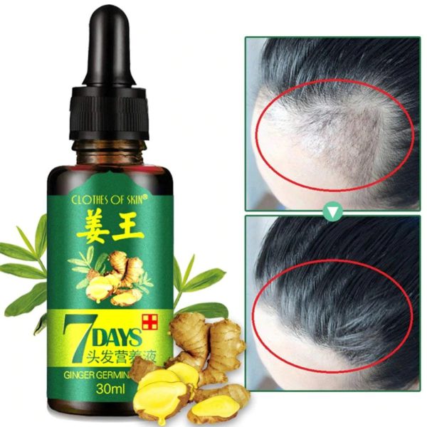 7 Day Ginger Germinal Oil Hair Nutrient Solution